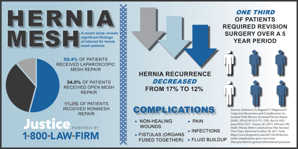 hernia mesh infographic 1800LAWFIRM